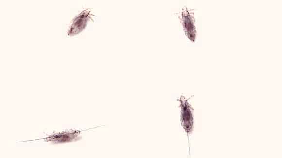 Body Lice - Symptoms, Diagnosis, Treatment of Body Lice ...